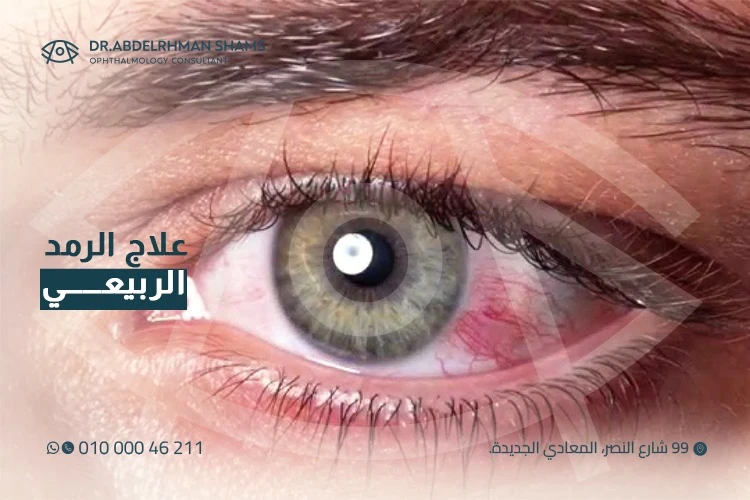 علاج الرمد الربيعي | افضل طرق العلاج الفعالة